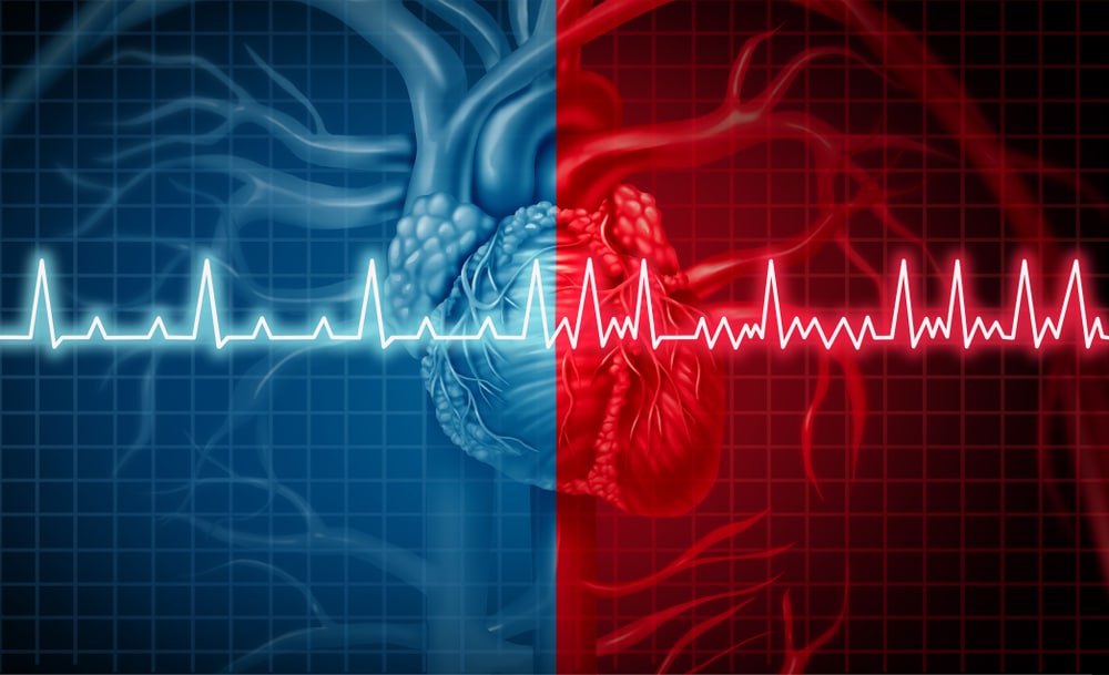Atrial Fibrillation Irregular Heartbeat ECG Monitoring in a 3D Illustration of a Heart