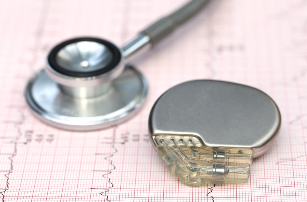What You Need to Know about Pacemaker Implantation - The Heart Rhythm ...